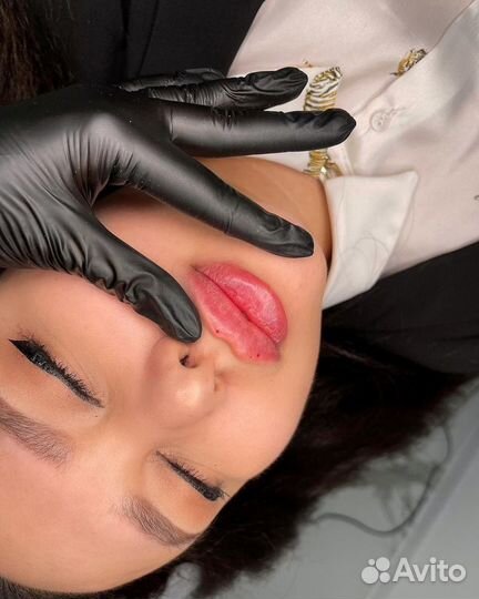 Увеличение губ