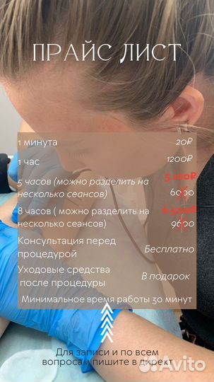 Электроэпиляция