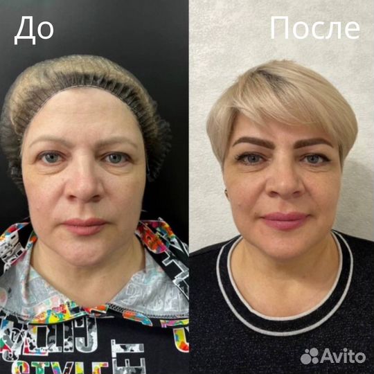 Услуги косметолога