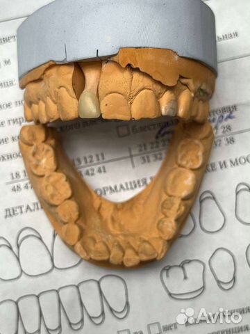 Услуги врача стоматолога-ортопеда
