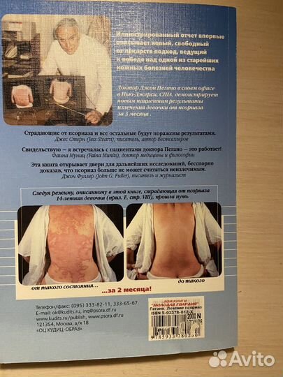 Лечение псориаза Джон Пегано