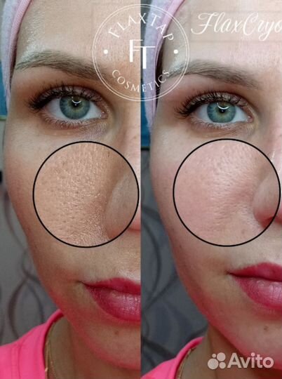 Красота и молодость без уколов и боли