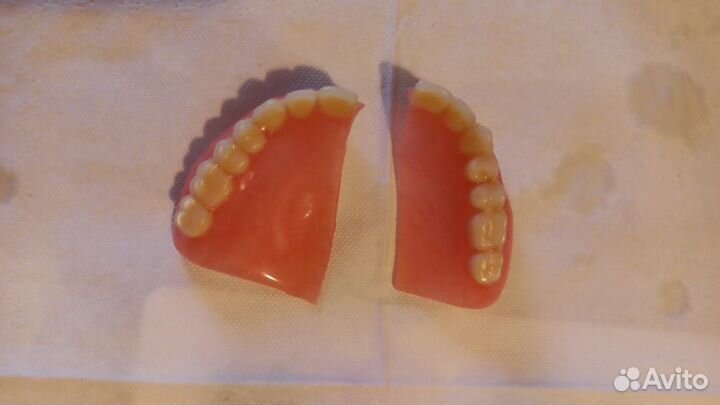 Срочный ремонт зубных протезов В Москве