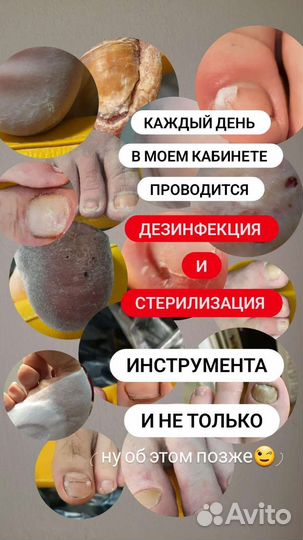 Услуги подолога