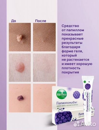 Папилломафит