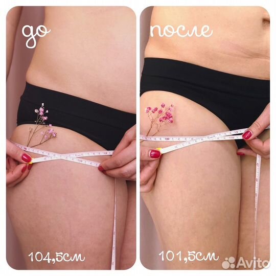 Скульптурирующий массаж