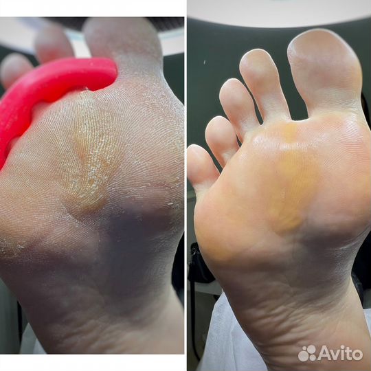 Подолог, мастер педикюра