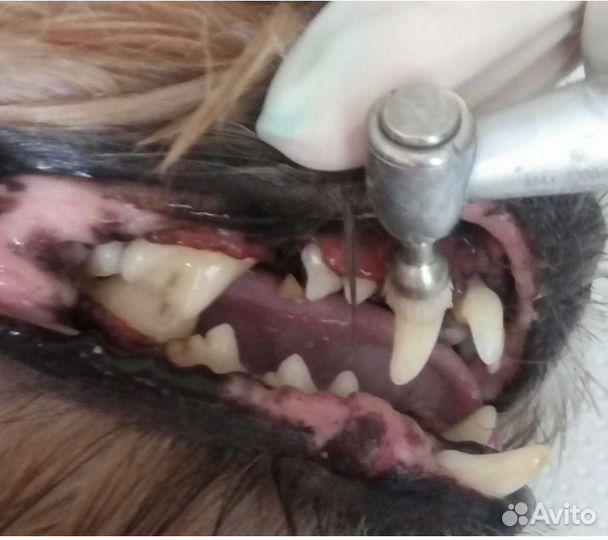 Чистка зубов ультразвуком с выездом на дом