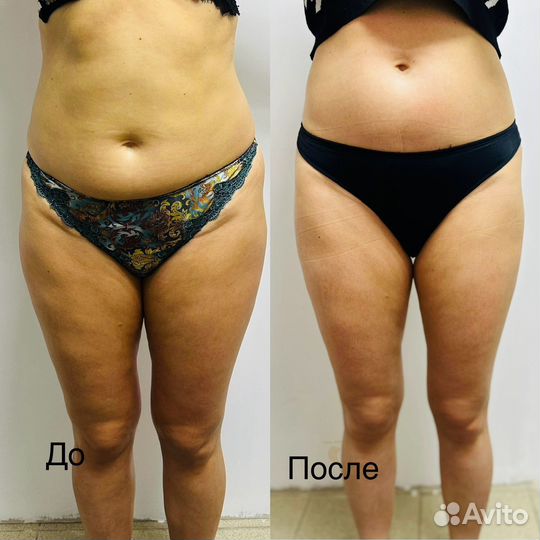 Коррекция фигуры