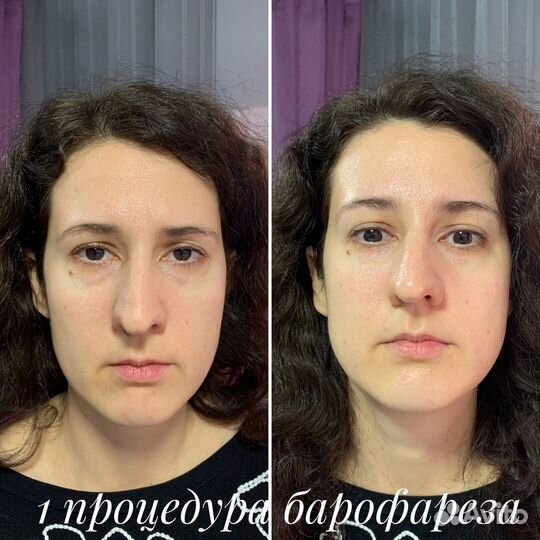 Услуги косметолога