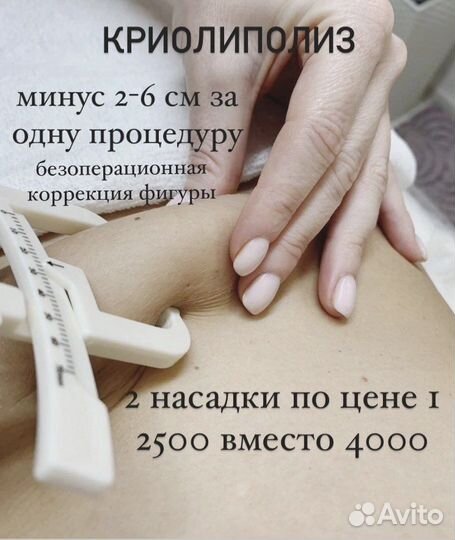 Криолиполиз