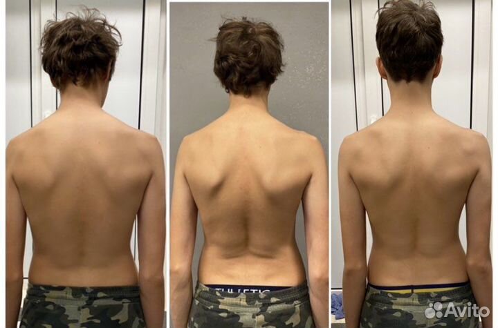 Коррекция осанки,устранение болей зажимов или спаз