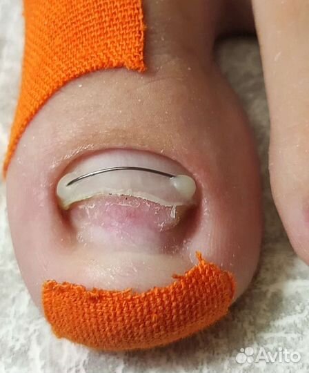 Подолог/Педикюр/Выезд возможен