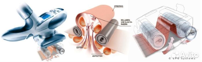 Вибромассаж для похудения
