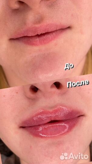 Уход за лицом