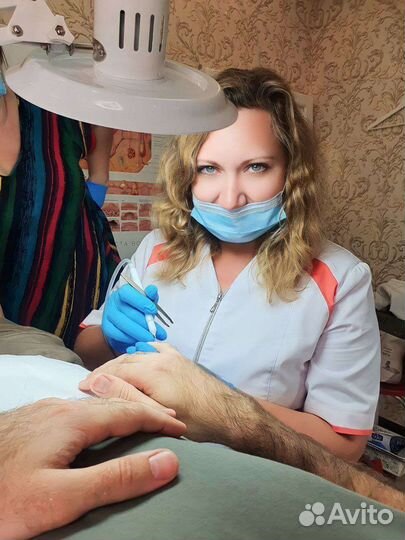 Электроэпиляция