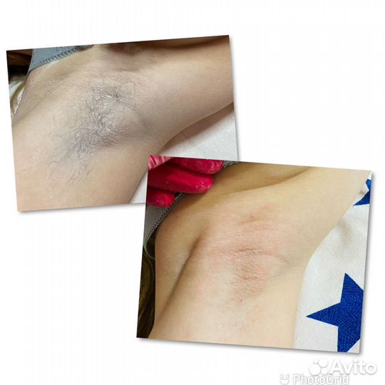 Педикюр,шугаринг