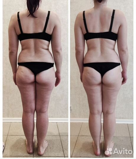 Мадеротерапия,тела и лица. Снижение веса и объёма