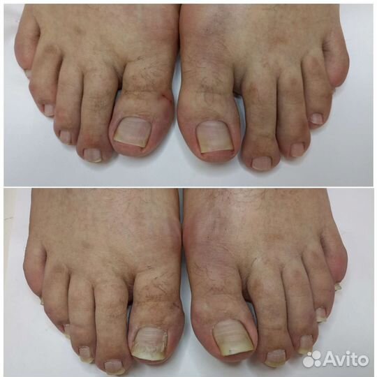 Медицинский педикюр-подолог. Маникюр