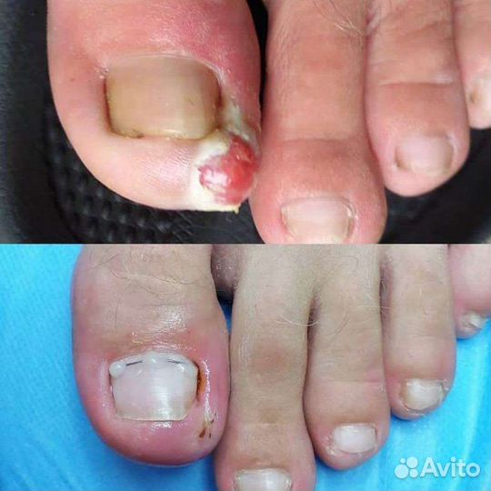 Подолог Педикюр Маникюр