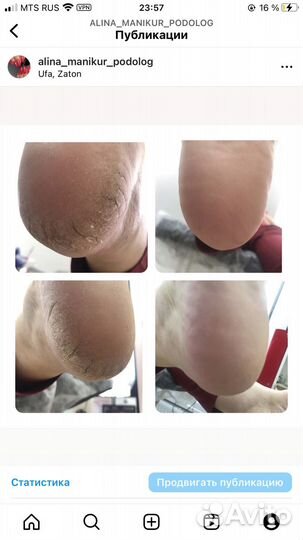 Маникюр/педикюр/подолог