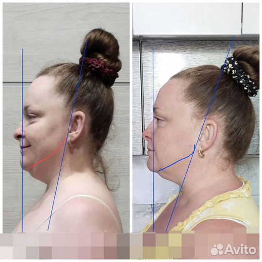 Восстановление естественной красоты