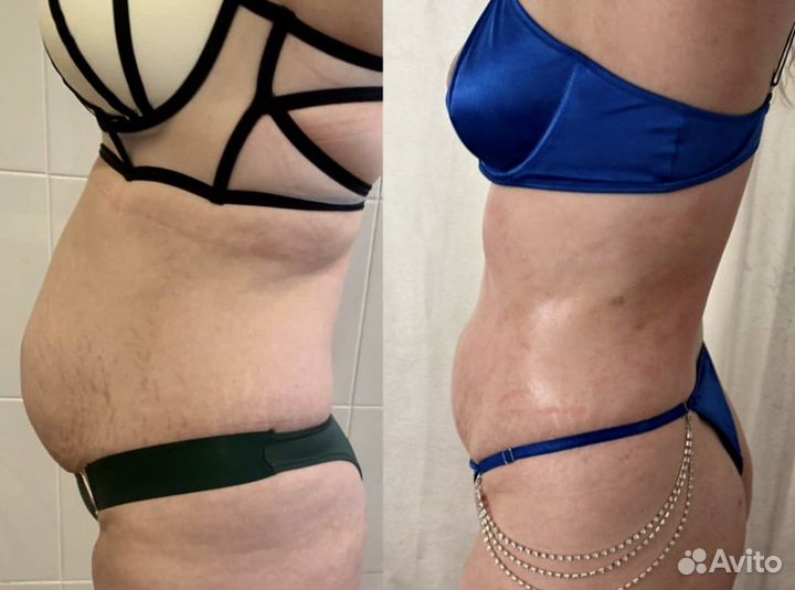 Коррекция фигуры