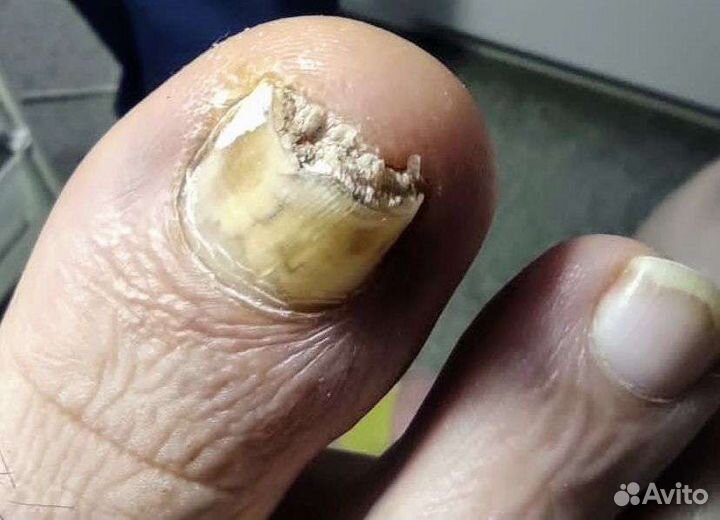 Педикюр,Подолог