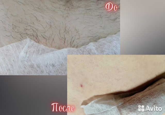 Мужской шугаринг