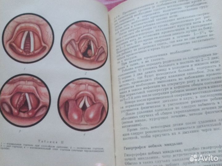 Лихачёв Болезни уха, горла и носа 1969 г