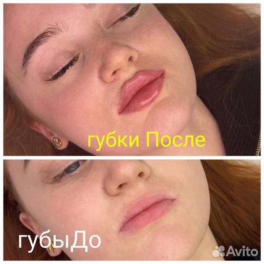 Услуги косметолога