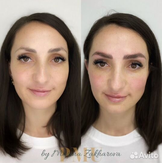 Волосковая техника, удаление пм,татуаж,перекрытие