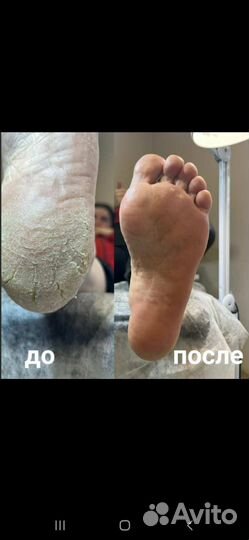 Подолог, смарт педикюр, маникюр izi