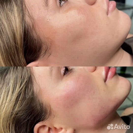 Услуги косметолога