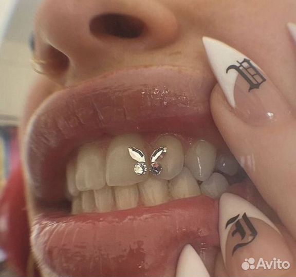 Установка скайсов