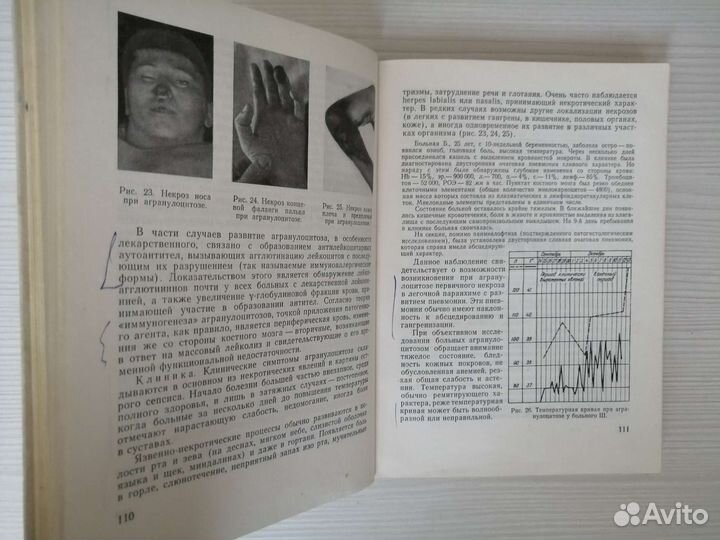 Клиническая гематология (1968г.) / Г. Даштаянц