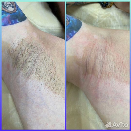 Модели на шугаринг пионерский