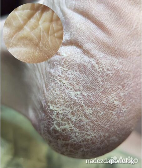 Подолог, педикюр, ортопедические стельки, обучение