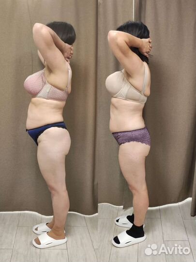 Модель на аппаратные методики коррекции фигуры