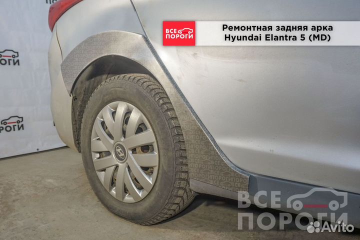 Рем арки для Hyundai Elantra V (MD)