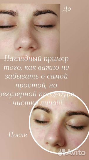 Услуги косметолога